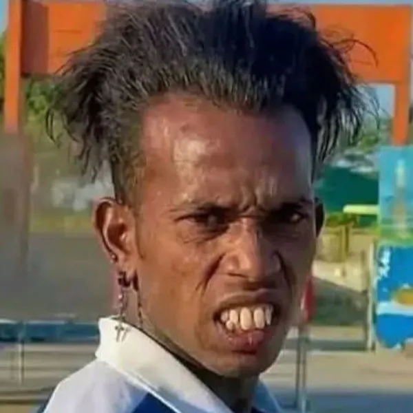 dp